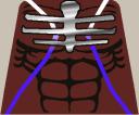 LordZedd