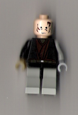 anakin_operation.jpg