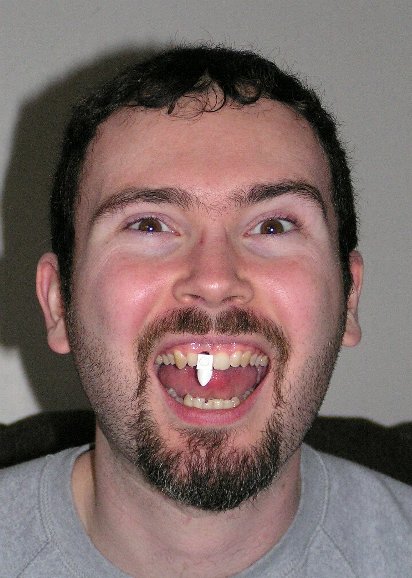1x1_tooth_as_tooth.jpg