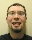 broken_tooth_-_smiling.jpg