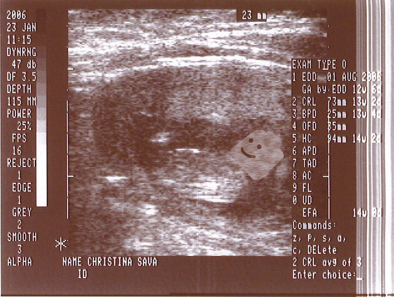 aaaaa_baby.jpg