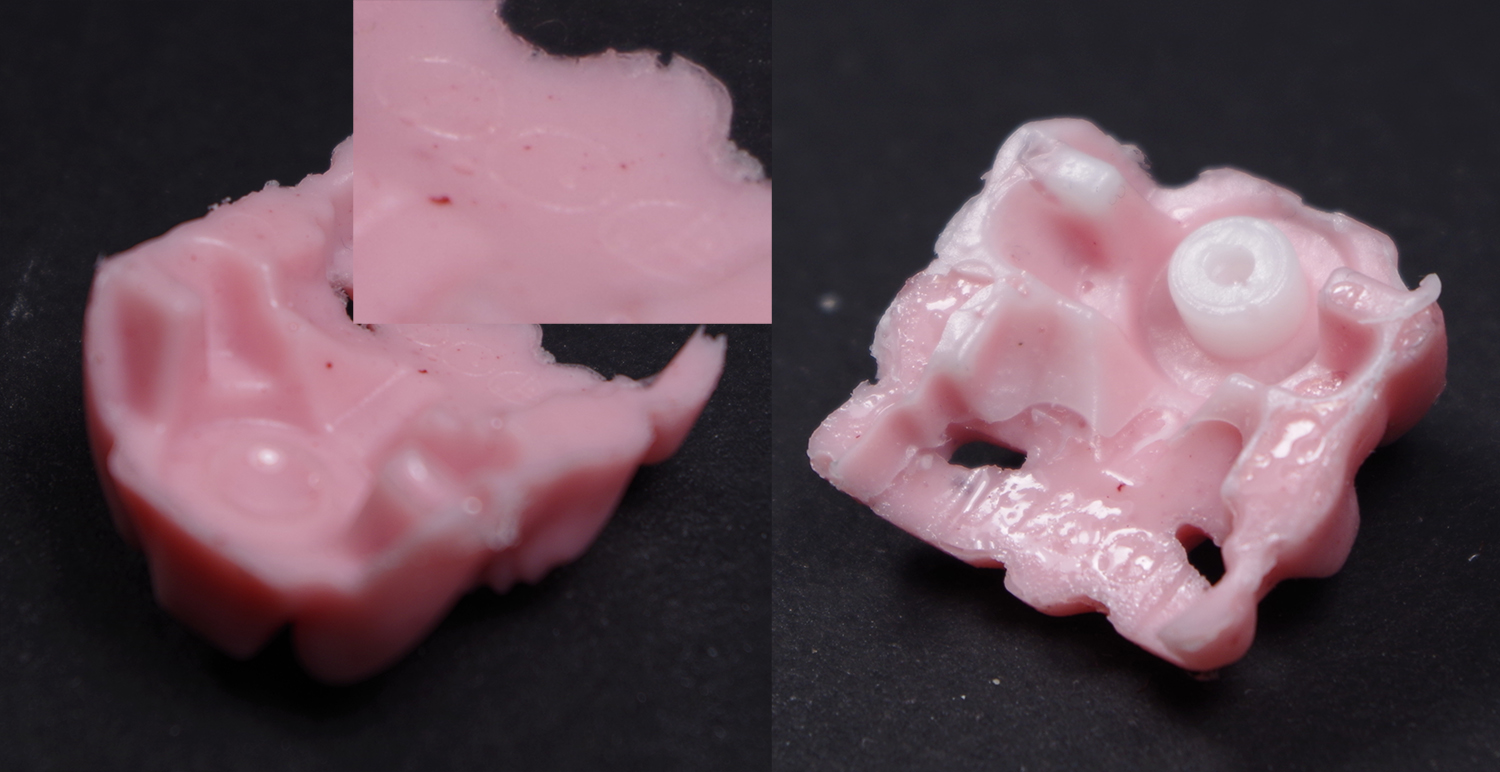 peg_transplant_before_and_after.jpg