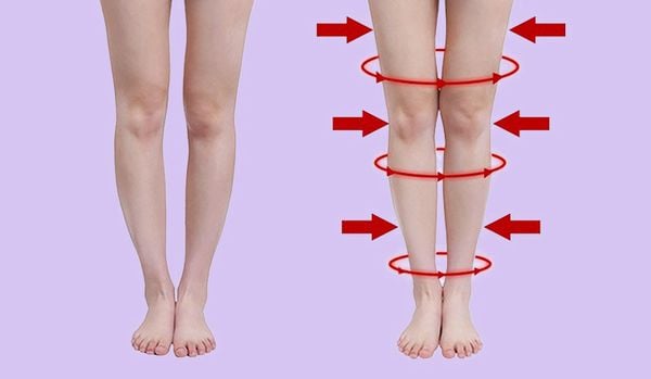 Làm thế nào để có đôi chân thẳng tắp? Gallery 2