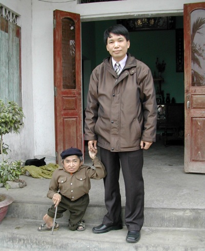 Ai là người lùn nhất Việt Nam?
