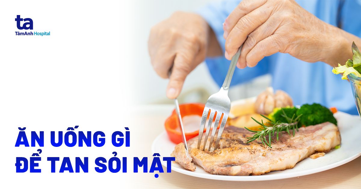 Ăn uống gì để tan sỏi mật?
