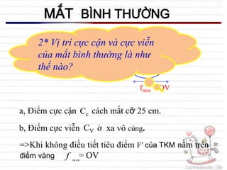 Điểm cực cận của mắt cận thì như thế nào? Gallery 2