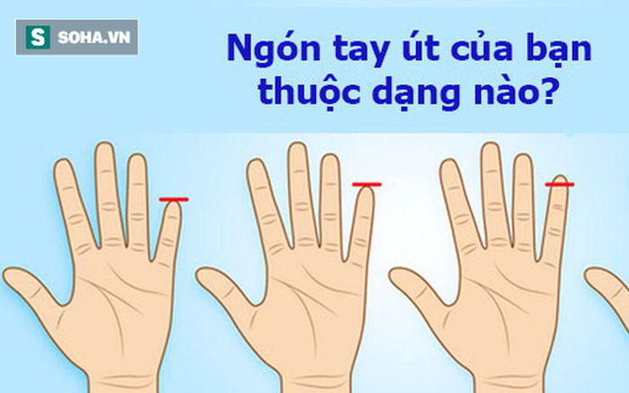Ngón Tay Út Ngắn: Nguyên Nhân, Ảnh Hưởng và Cách Khắc Phục Gallery 2