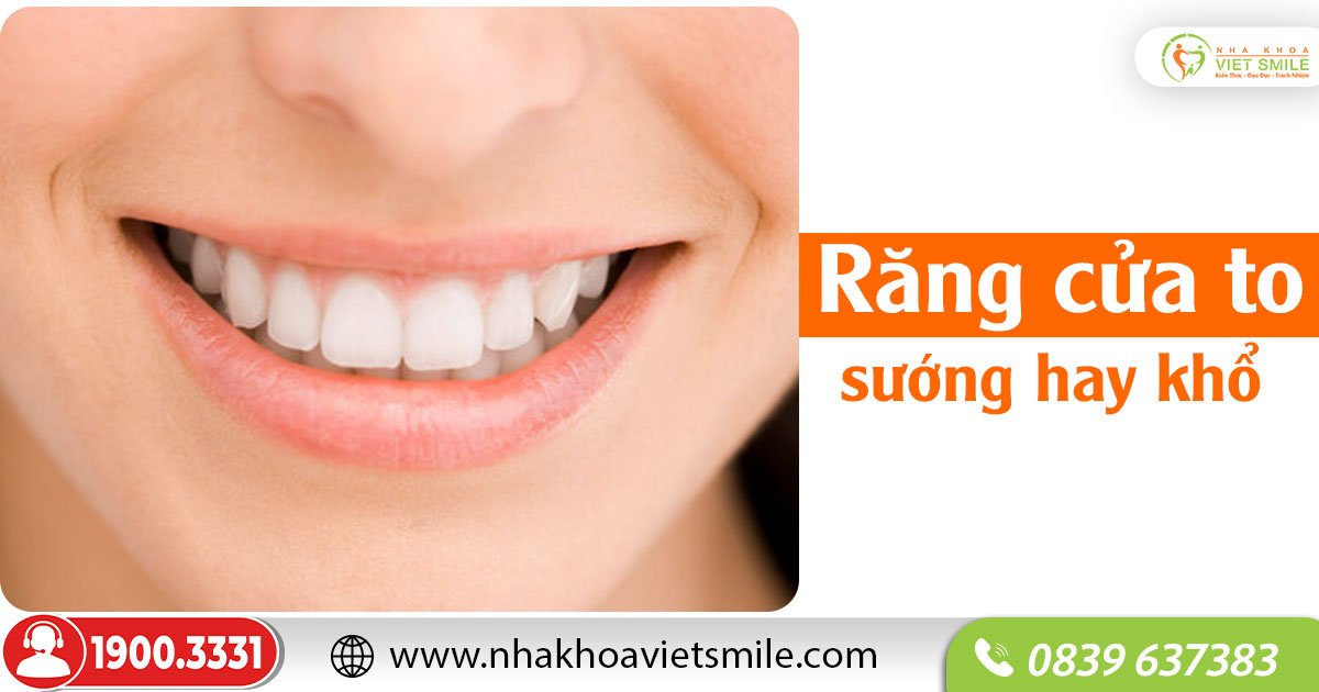 Răng cửa to sướng hay khổ? Gallery 2