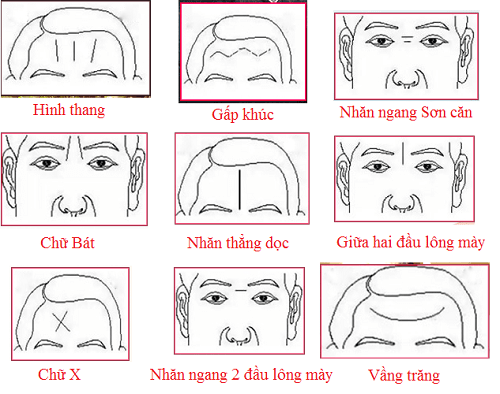 Trán Nhăn Tướng Số: Giải Mã Bí Ẩn Vận Mệnh Gallery 2
