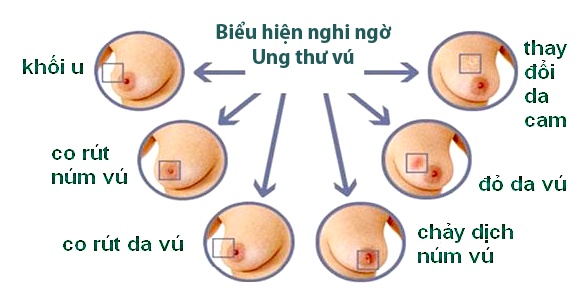 Vú to tròn trắng Gallery 2