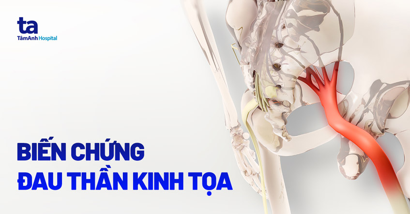 Hành Hình Róc Xương Gallery 2