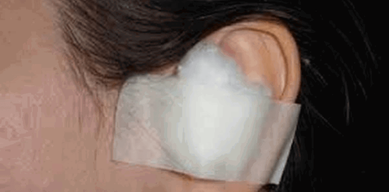 Bà De Bịt Tai Đi Tất Bao Lâu?