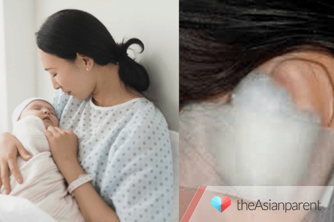 Bà De Bịt Tai Đi Tất Bao Lâu? Gallery 2