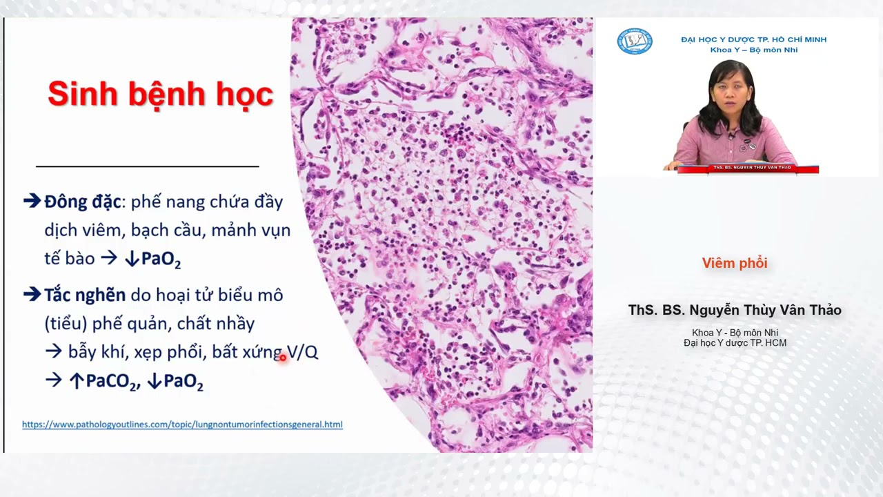 Bài giảng Viêm phổi