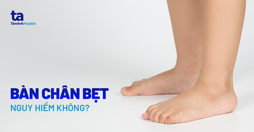 Bàn chân bẹt có nguy hiểm không?