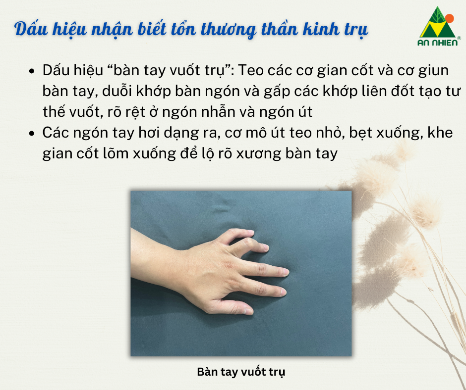 Bàn Tay Vuốt Trụ Là Gì?