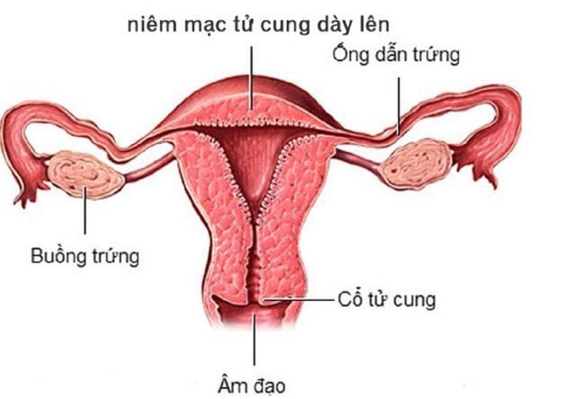 Bề dày nội mạc tử cung bình thường là bao nhiêu?