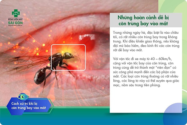 Côn trùng bay vào mắt gây đau rất nhiều: Cách xử lý và phòng ngừa