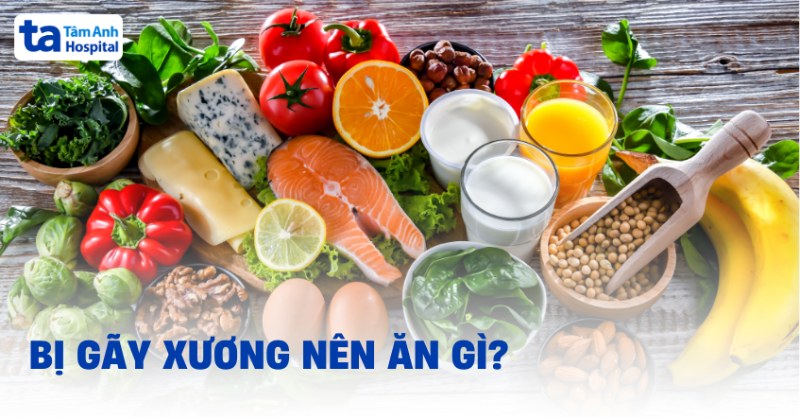 Bị gãy xương nên ăn gì cho mau lành?