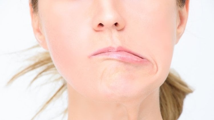 Bị Méo Miệng Phải Làm Sao?