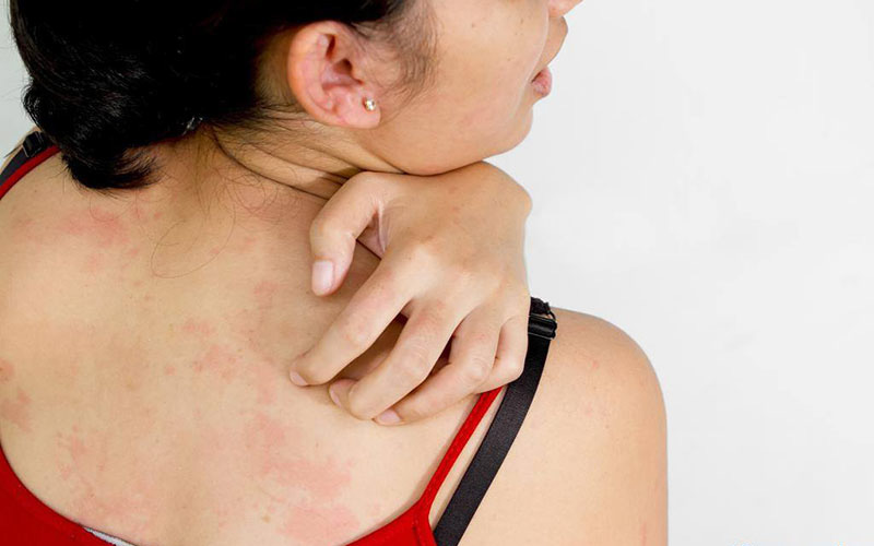 Ngứa Lưng Vào Ban Đêm: Nguyên Nhân và Cách Khắc Phục