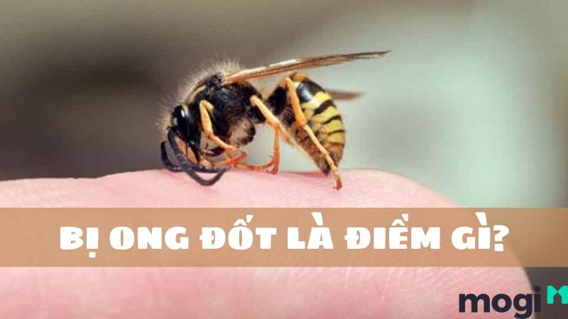 Bị Ong Chích Đánh Con Gì?
