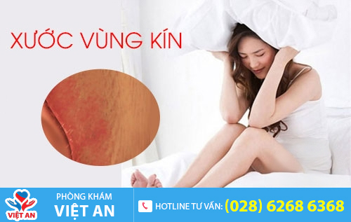Bị Xước Bên Ngoài Vùng Kín: Nguyên Nhân, Triệu Chứng và Cách Điều Trị