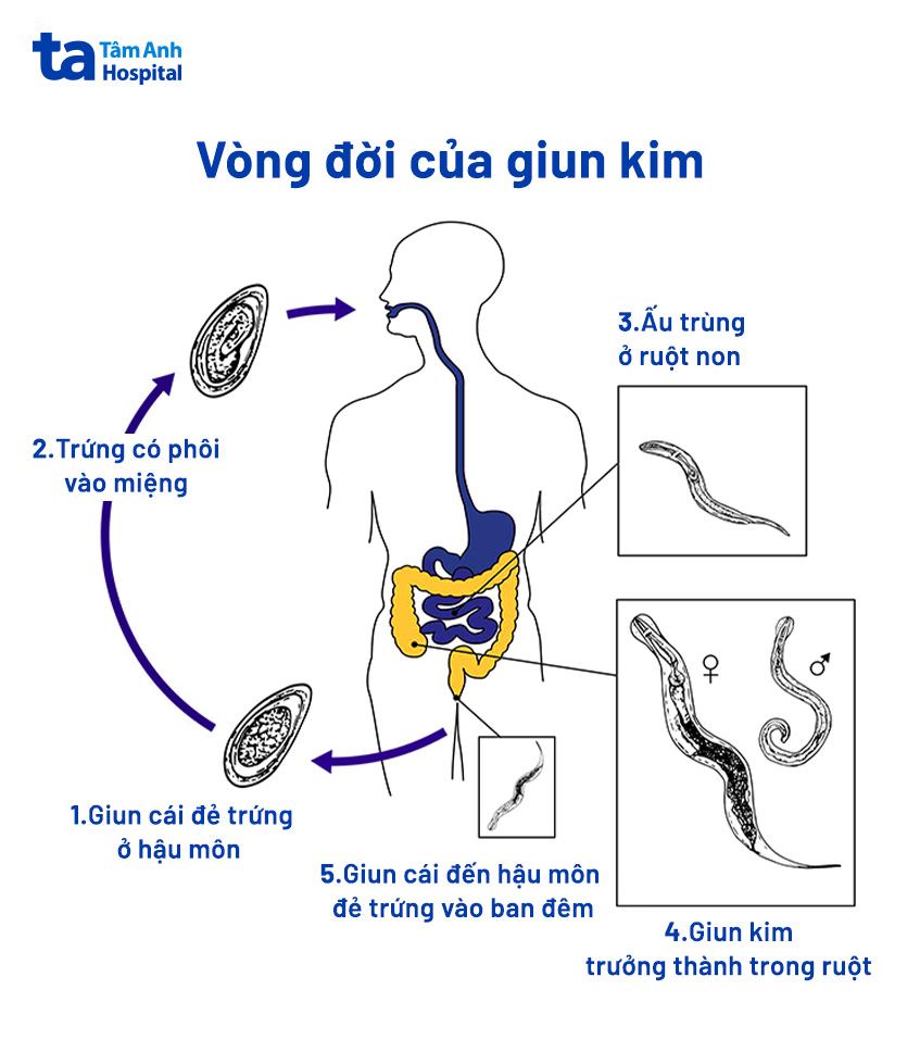 Cách Trị Giun Kim Ở Hậu Môn Cho Bé Gallery 1