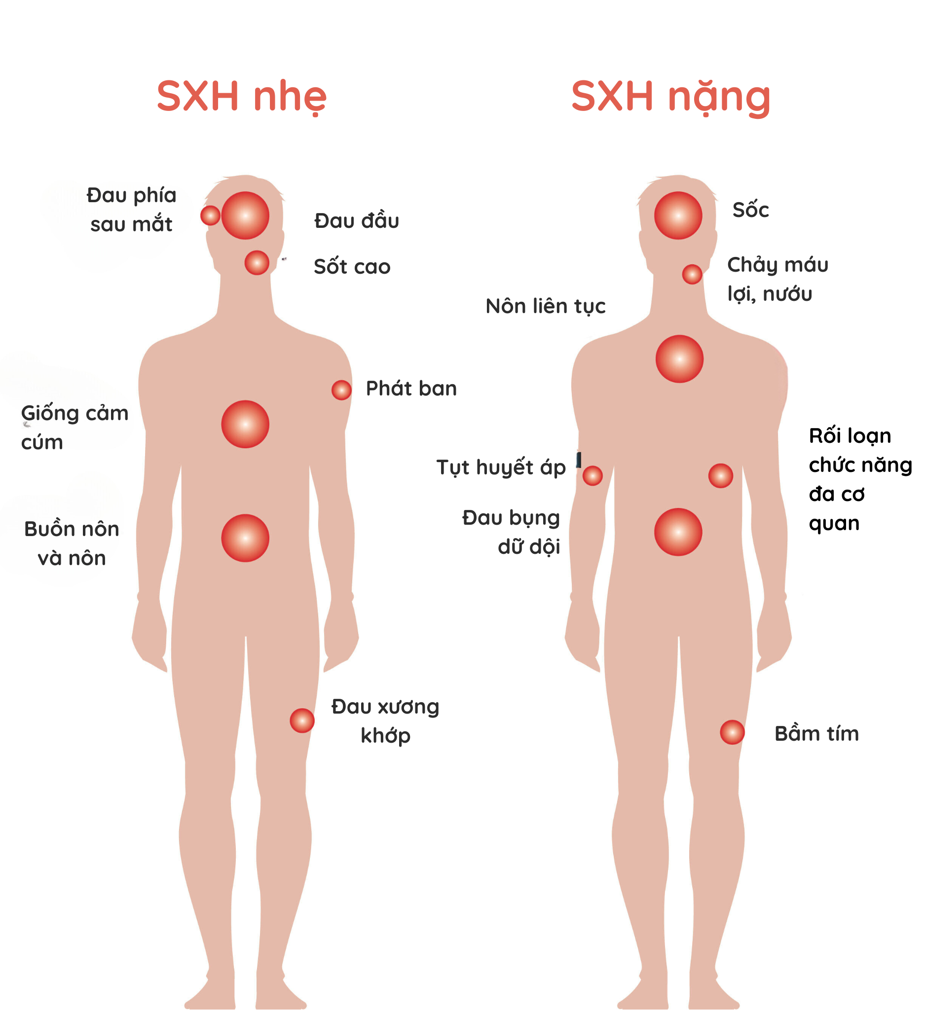 Sót Xa Là Gì? Nguyên Nhân, Biểu Hiện Và Cách Khắc Phục Gallery 2