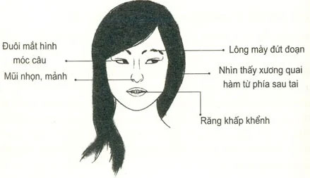 Biểu Hiện Của Người Chậm Chạp