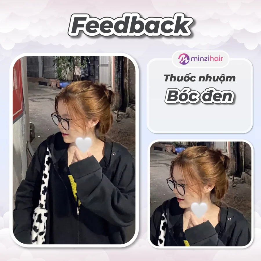 Bóc đen là gì? Gallery 2