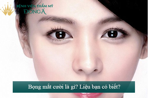 Bọng mắt cười là gì? Gallery 2
