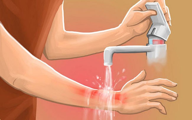 Bỏng ớt có khỏi không?