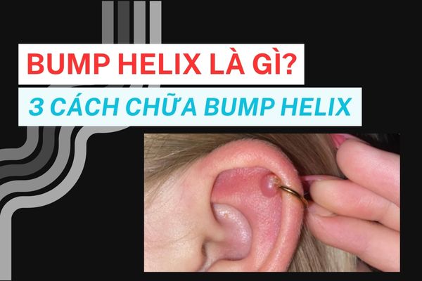 Bump Bài Là Gì?
