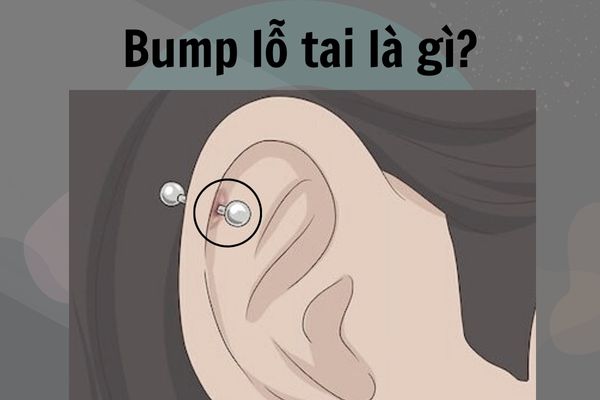 Bump Bài Là Gì? Gallery 2