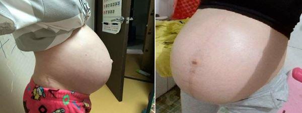 Bụng Tụt Là Như Thế Nào?