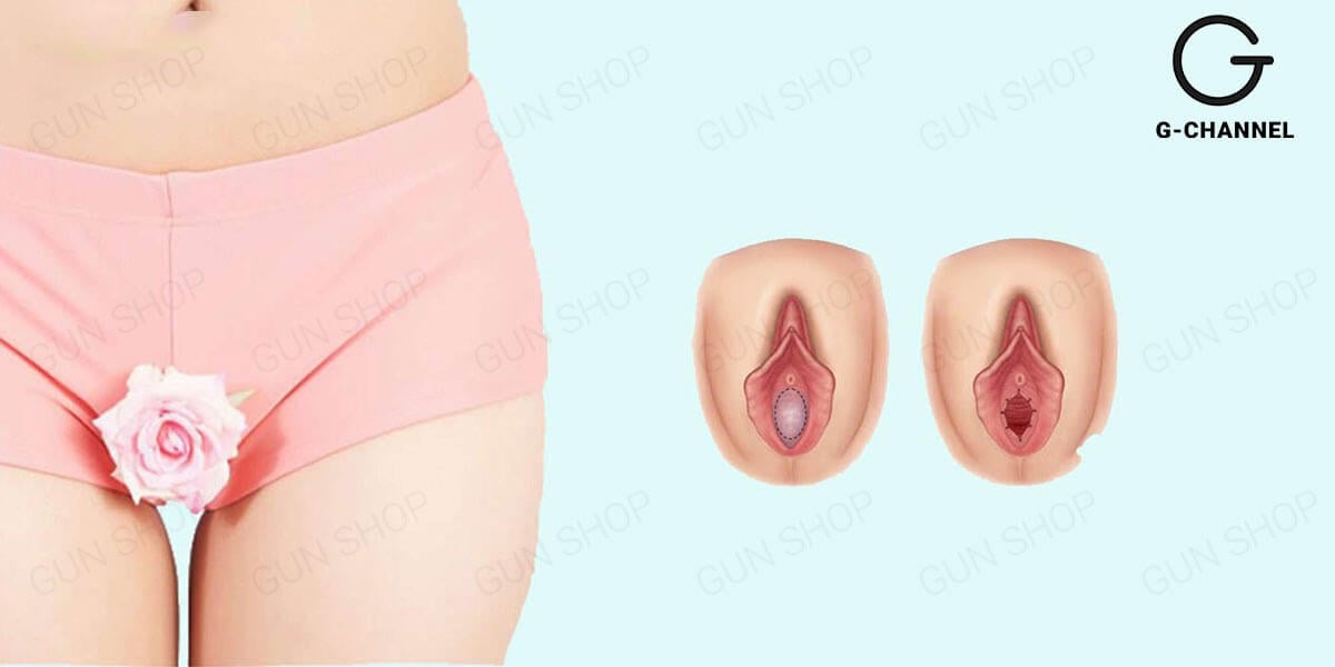 Bướm Hồng Không Che