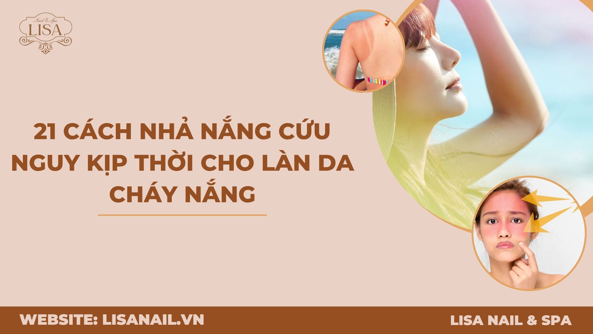 Cách Nhả Nắng Nhanh Gallery 1