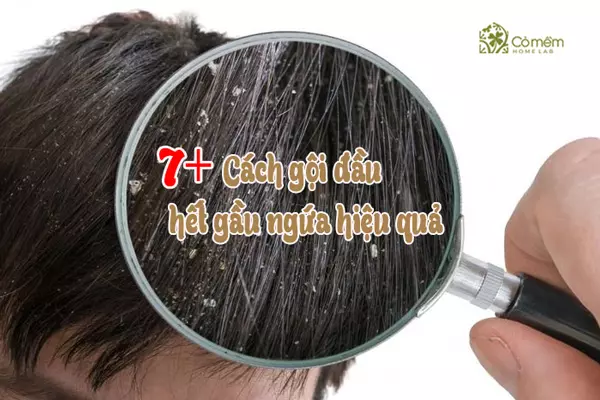 Làm Sao Để Đầu Hết Gầu? Gallery 2