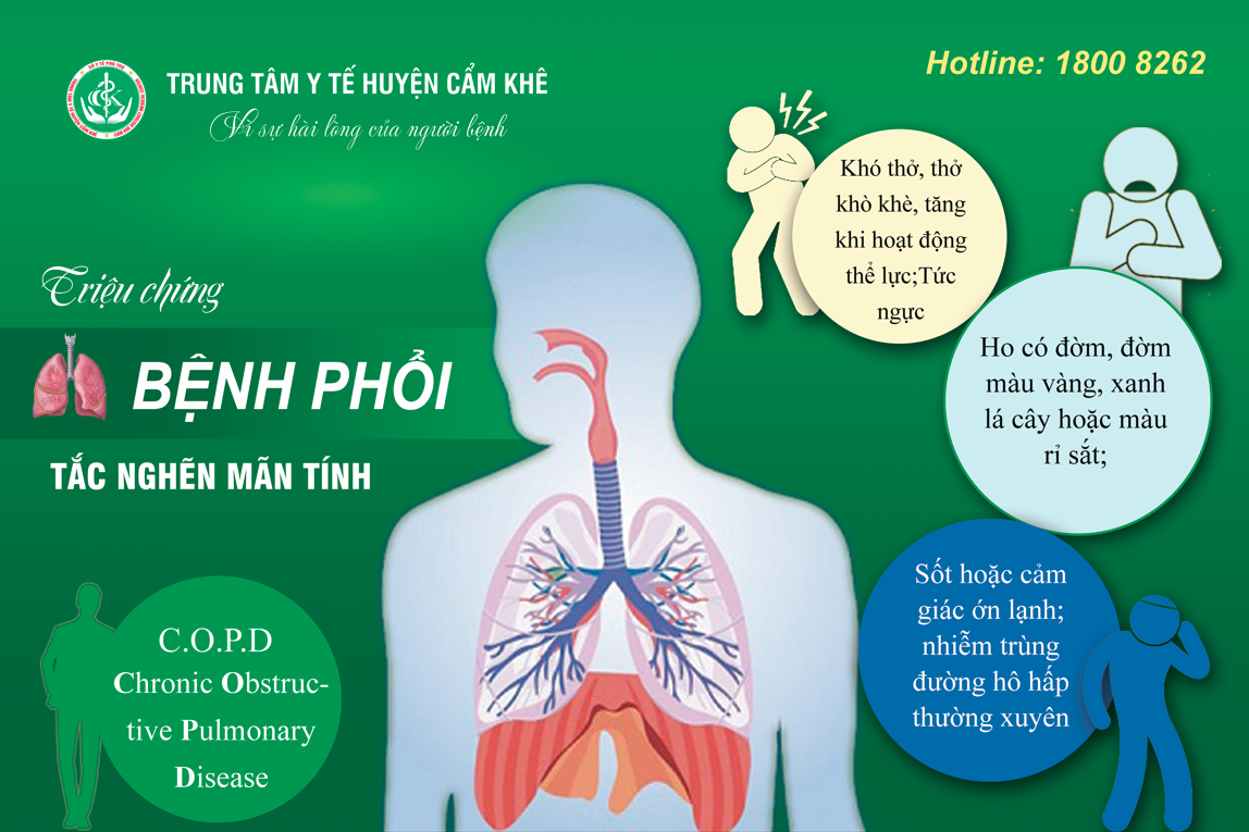 Khuất mắc là gì? Gallery 1