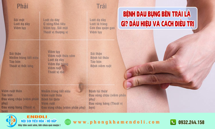 Vững Trãi Là Gì? Gallery 1
