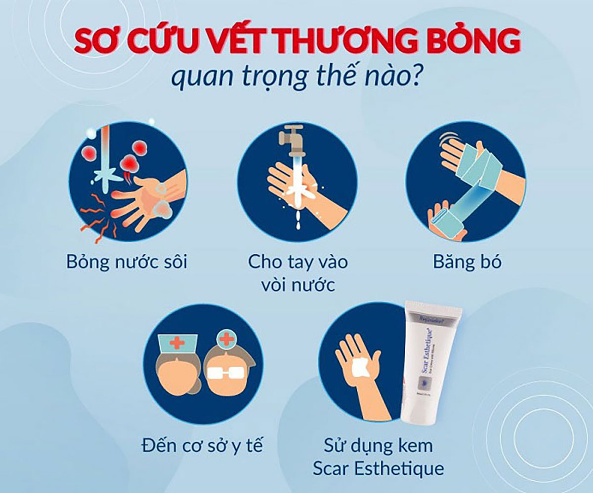 Cách Chữa Bỏng Bô Hiệu Quả và An Toàn Gallery 1
