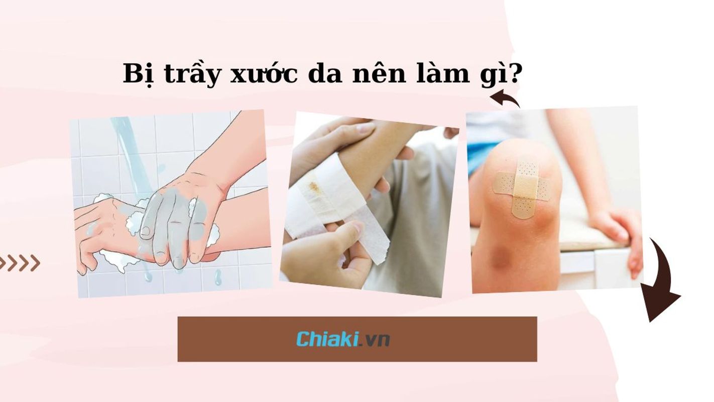 Bị ngã xe trầy xước phải làm sao? Gallery 1