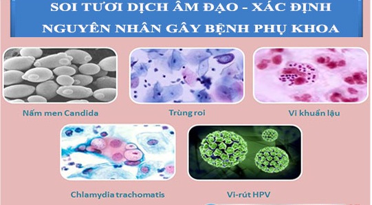 Phương pháp soi tươi vi khuẩn Gallery 1