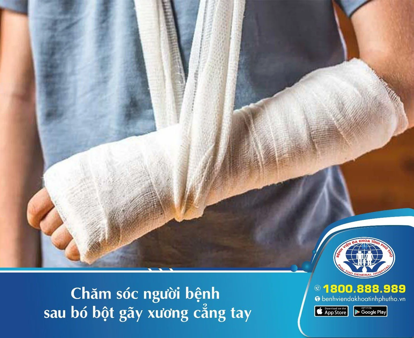Gãy Tay Bó Bột: Hướng Dẫn Chăm Sóc Và Phục Hồi Gallery 1