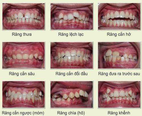 Lộn xộn là gì? Gallery 1