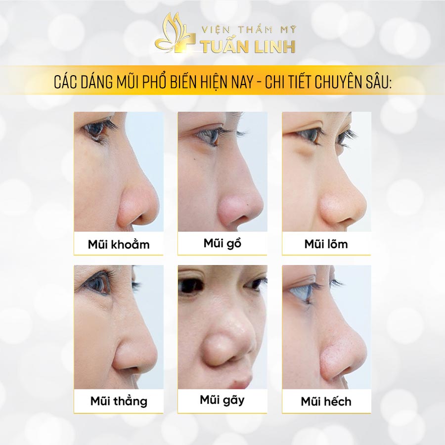 Các Hình Dáng Mũi Thường Gặp Và Đặc Điểm Của Chúng