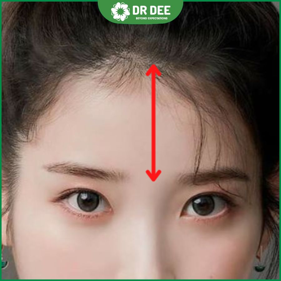 Trán ngắn mặt tròn để mái gì? Gallery 1