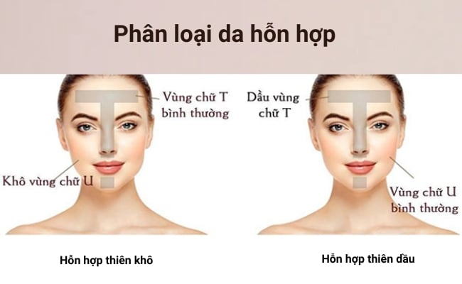 Thế nào là hỗn hợp? Gallery 1