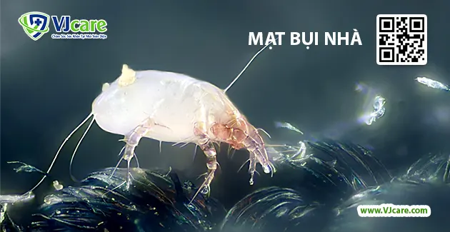 Mạt nhà là gì? Gallery 1